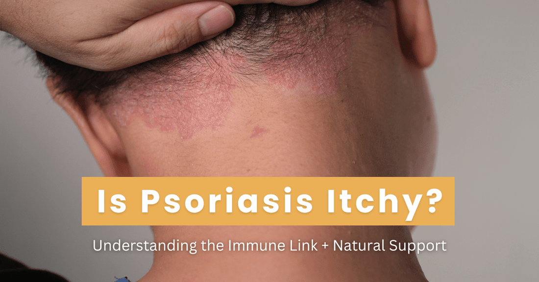 Is Psoriasis Itchy? Understanding the Immune Link and Natural Relief - Strength & Spices Ltd.