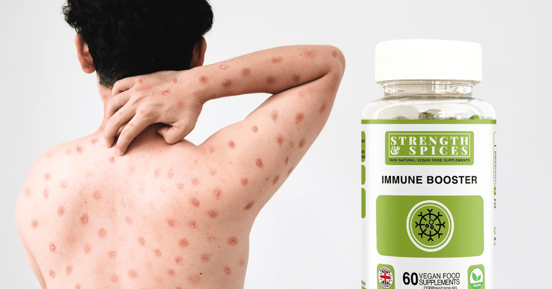 Strengthen Your Immune System: Combat the Threat of Monkeypox - Strength & Spices Ltd.